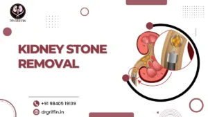 Kidney Stone Removal
