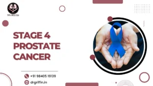 Stage 4 prostate cancer