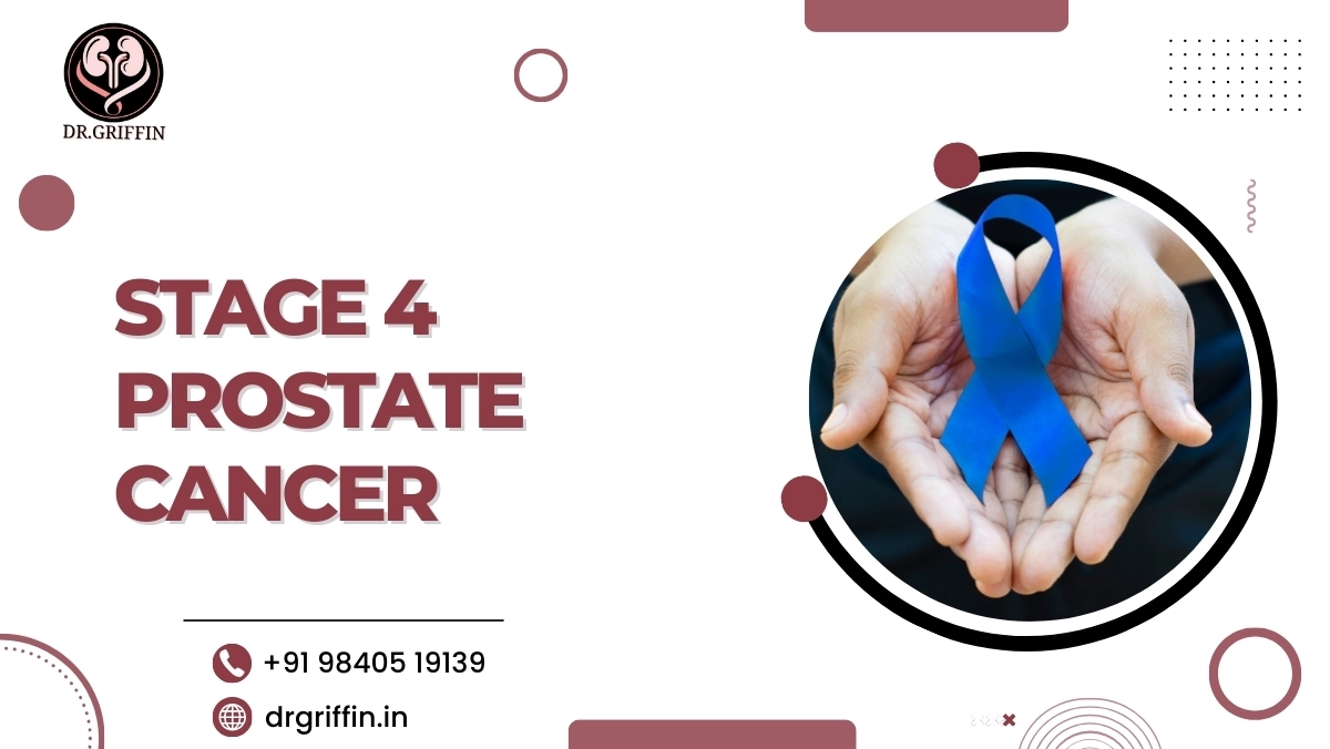 Stage 4 prostate cancer