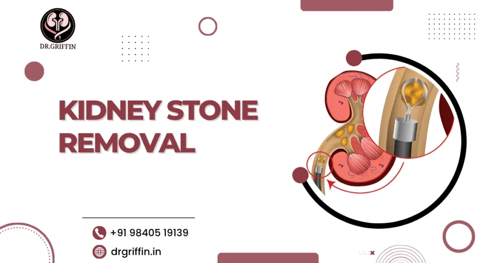Kidney Stone Removal