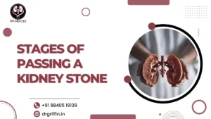 Stages of passing a kidney stone