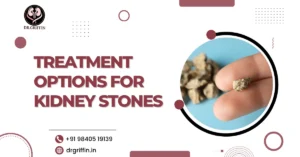 Treatment Options for Kidney Stones