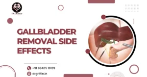 Gallbladder removal side effects