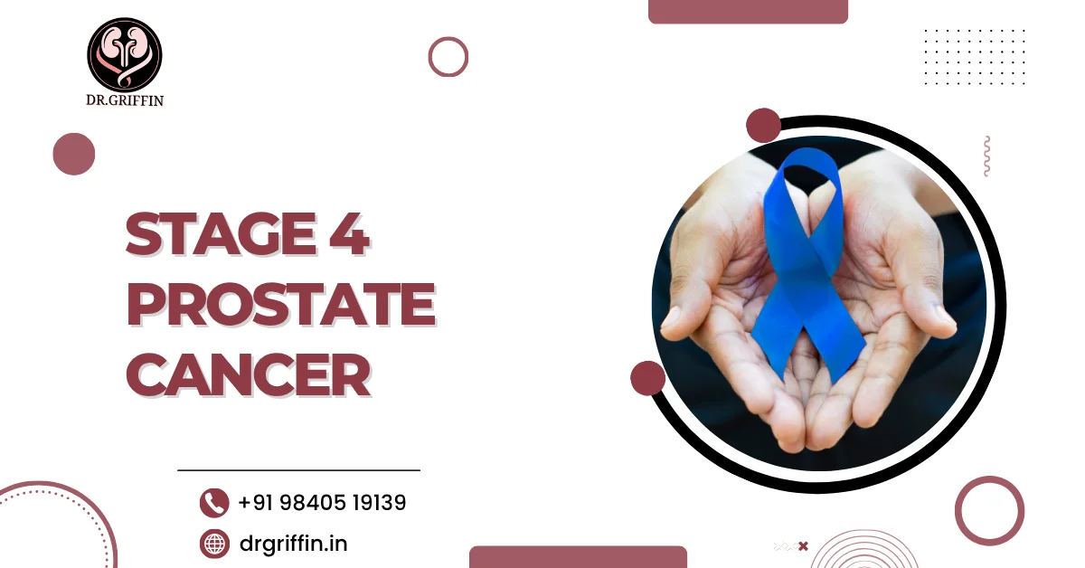 Stage 4 prostate cancer