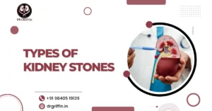 Types of Kidney Stones