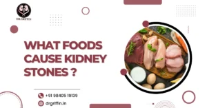 What Foods Cause Kidney Stones