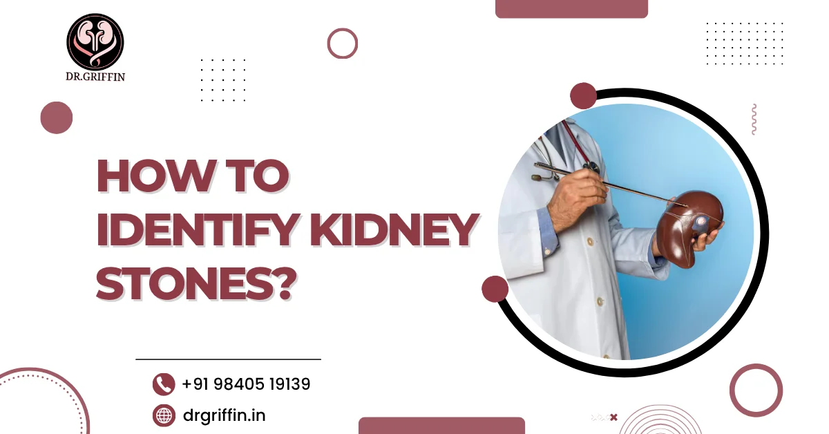 how to identify kidney stones