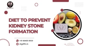Diet to Prevent Kidney Stone Formation