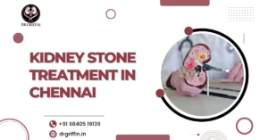 Kidney Stone Treatment in Chennai