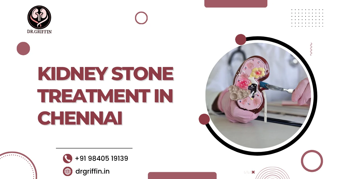 Kidney Stone Treatment in Chennai