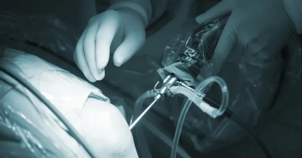 Minimally Invasive Urology
