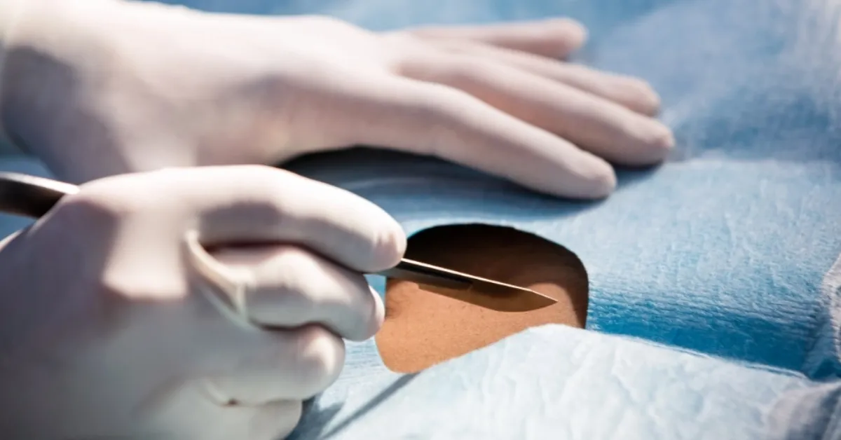 Urethral Repair