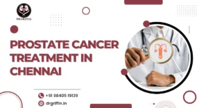Prostate cancer treatment in Chennai