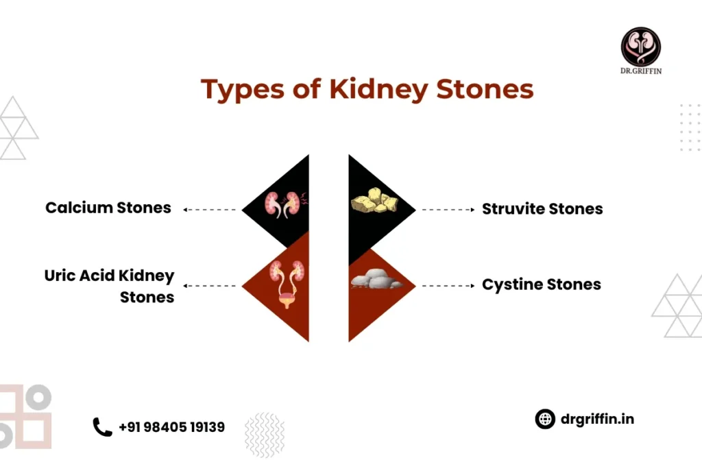 Types of Kidney Stones